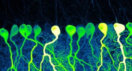 A confocal image of sparse GCaMP6f-expressing Purkinje cells in mouse cerebellum resembles the industrious contours of pre-dawn commuters.