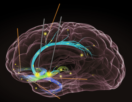 Human brain with 4 pathways lit up