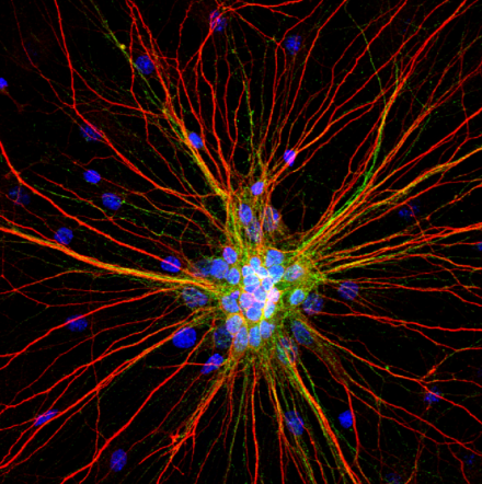 Scan image of neuron