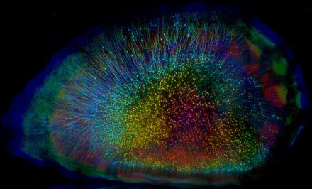 Whole mouse brain with rainbow colored neurons.