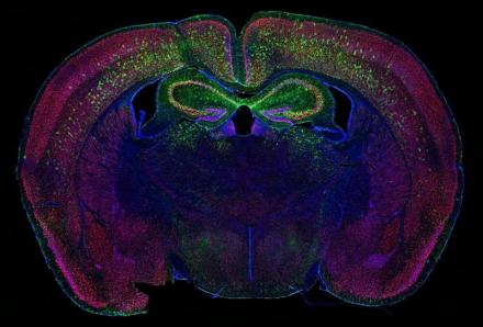 Coronal slice of the brain with brilliant green, blue, and magenta colored probes throughout.