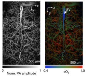Brain vasculature imaged through intact mouse skull (left). Oxygen saturation levels of hemoglobin measured with photoacoustic microscopy (right). Source: doi:10.1038/nmeth.3336