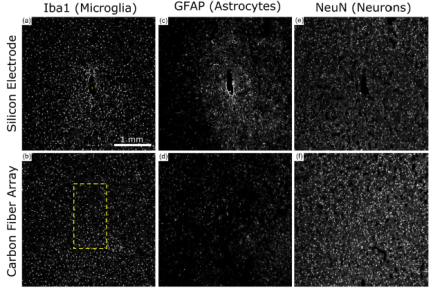 The top row shows histological images from brain tissue probed with a silicon electrode, while the bottom row shows examples utilizing the newly designed carbon fiber electrode array. The implantation site of the carbon fiber array demonstrates significantly less Iba1 (microglia) and GFAP (astrocyte) expression (indicators of an immune/inflammatory response from tissue damage), and more NeuN (neurons) staining compared to the area around the silicon electrode.