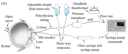 A syringe pump injects or withdraws fluid from the eye via a needle inserted into the anterior chamber through the peripheral cornea, while a second needle connected to a pressure transducer records intraocular pressure (IOP). This procedure gives an indirect measurement of intracranial pressure (ICP).