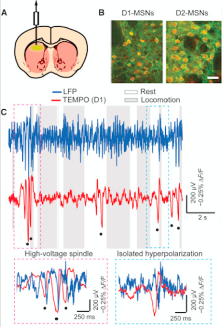 Panels A and B illustrate the targeting of distinct neuronal subtypes (D1 or D2-expressing striatal neurons) with a genetically-encoded green voltage sensor and red reference in transgenic mice. Panel C illustrates two, distinct forms of hyperpolarization (marked with black dots: high-voltage spindles and temporally isolated events) that were measured by TEMPO in D1-expressing neurons while animals were at rest.