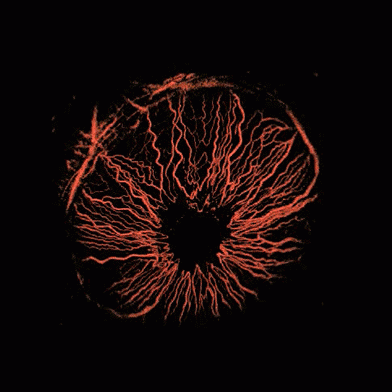 Photoacoustic microscopy reveals the detailed structure of blood vessels in the iris of a mouse eye. Source: Lihong Wang/Optical Imaging Laboratory/Washington University