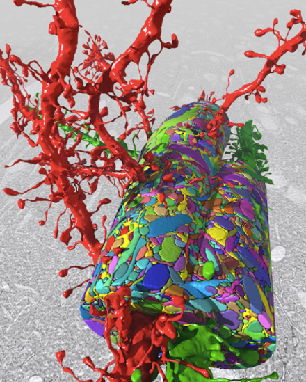 A new technique for sectioning and imaging brain tissue allows researchers to reconstruct the connections among individual neurons. (Image use with permission of J.W. Lichtman.)