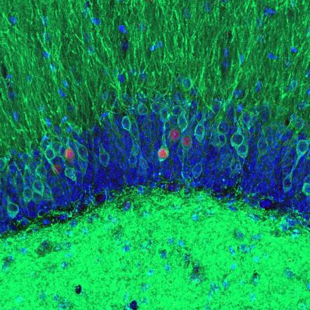 The Intersection of Memory and Memory  - First Place Photo Winner. A cluster of neurons in a mouse hippocampus colored green and blue with a few active neurons colored red.