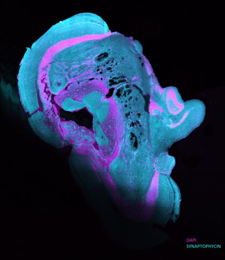 Zebrafish Brain Thinking Abraham Lincoln  - Third Place Photo Winner. Image taken from Zebrafish brain tissue shows fluorescent blue and pink colors against a black background. The shape of the tissue section looks like Abraham Lincoln's side profile.