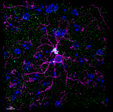 Submit your photos or videos by April 15 for the NIH BRAIN Initiative’s Photo and Video Contest. An image of microglia, colored purple and blue digesting nerve terminal cells, colored green. Image courtesy of Bu M., from the 2023 BRAIN Photo and Video Contest.