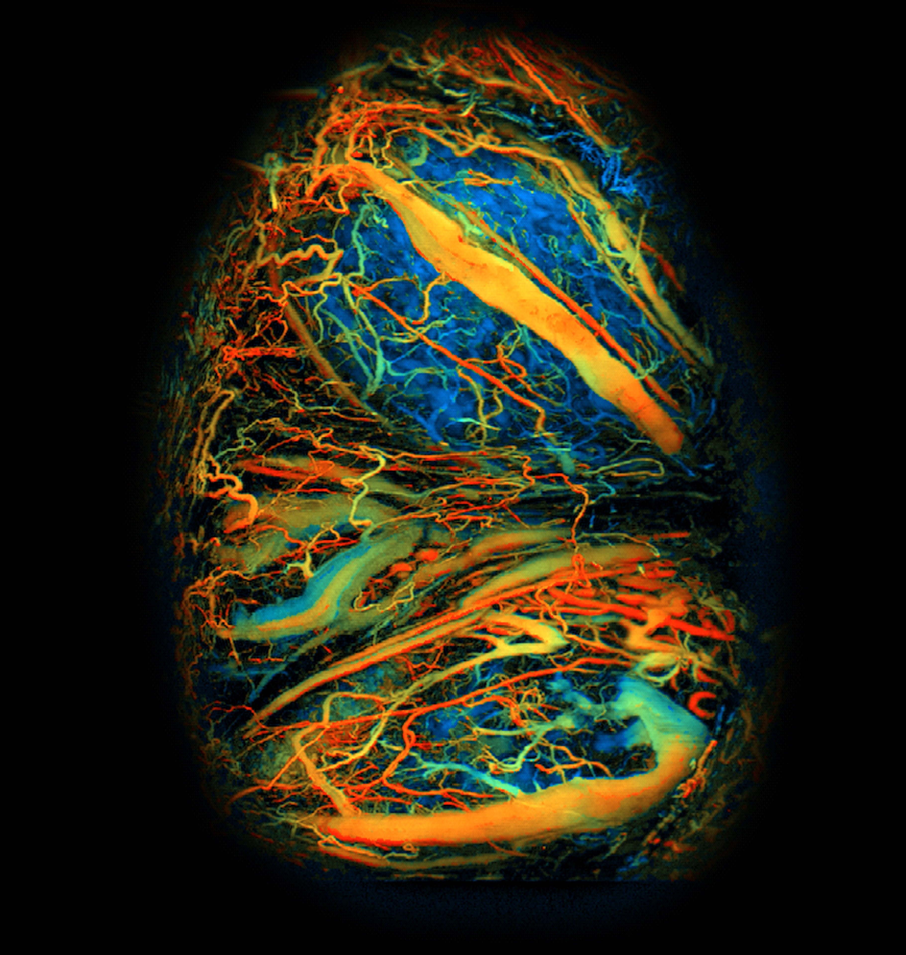 Photoacoustic microscopy image of a developing mouse placenta