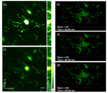 Representative images capturing changes in microglia morphology in the mouse cerebral cortex over time using a combination of OPLUL and IMPACT imaging techniques. Panels (b) and (c) depict two different correction methods for imaging the fine details of microglia in deep tissue. Panels (e) through (g), taken across subsequent time points, show the ability to capture fast occurring events like a leukocyte patrolling blood vessels (note the appearance and disappearance of the cell next to the microglia, circl