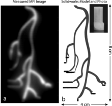 Example of an experimental MPI image used to detect a 3D printed coronary artery model. The image insert in the upper right corner is a 3D printed model of an arterial system, injected with the SPIO tracer solution (panel b). The image in panel (a) is the MPI image generated from detection of the SPIO tracer. The contrast and resolution of this technology as medical applications in detection of blood clots in arteries of the body or brain that could cause stroke, or tumor identification in cancer patients.