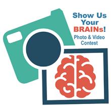 Illustrative camera icon with a photo of a brain.