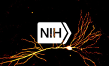 Yellow neuron.